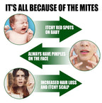 Green Prickly Ash Herbal Mite Remover